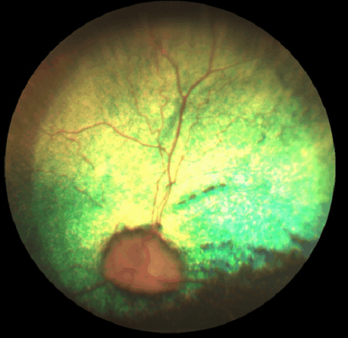 progressive retinal atrophy